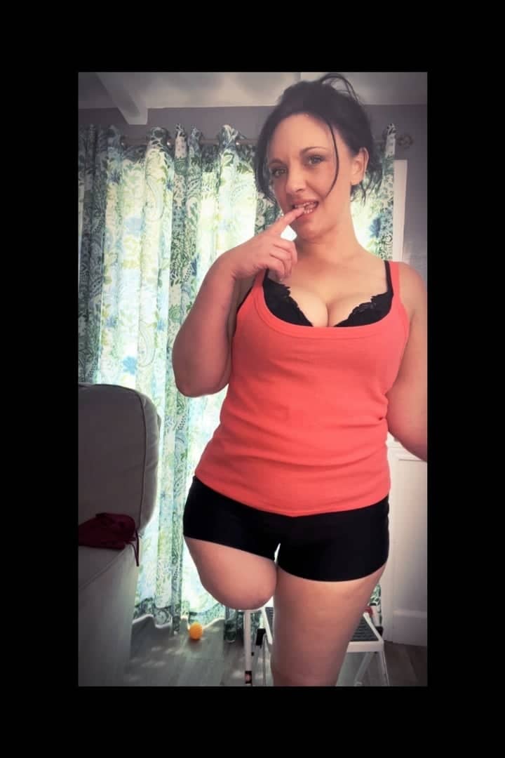 Amputeedarling | @amputeedarling